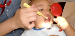 4歳のこどものあごの中のレントゲン写真。子供の歯の下では、大人の歯のたまごが、出番を待っています。